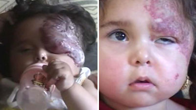 The Basra maternity hospital in southern Iraq have seen a 60% rise in birth defects since 2003. Doctors believe exposure to heavy metals in ammunition during the war is the only explanation.